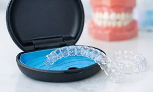 インビザライン