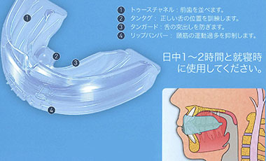 歯列矯正用咬合誘導装置(T4Kトレーナー、マイオブレース、マルチファミリー、プレオルソ、ムーシールド)